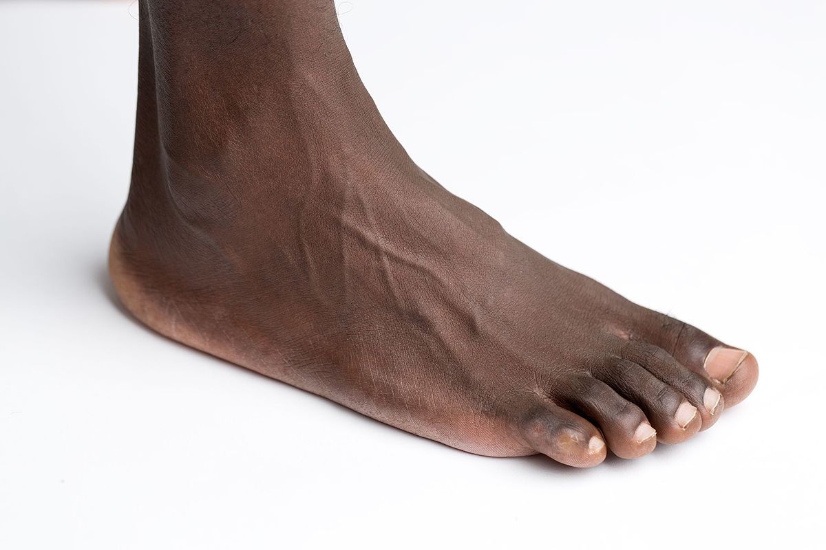 Foot Image